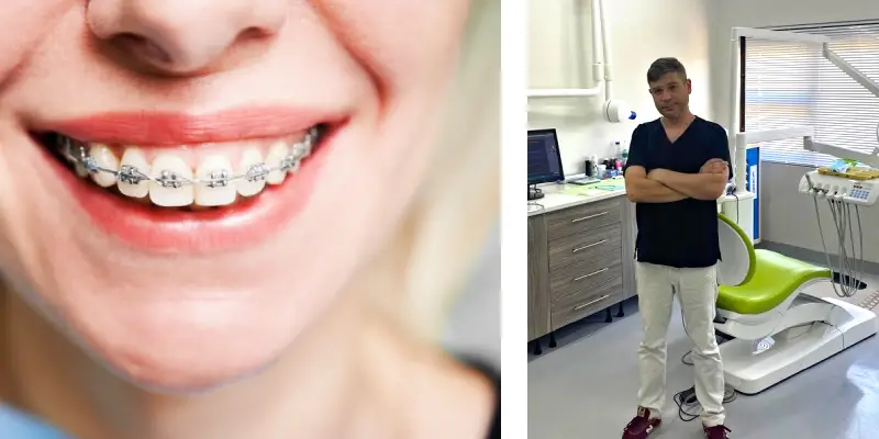 braces