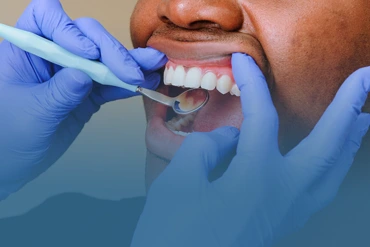 dental-check-ups